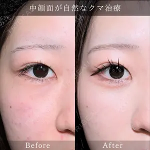 藤・ナチュレ美容クリニック 銀座院 小川 杏平医師の症例