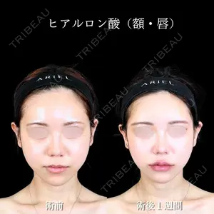 アリエル美容クリニック 大宮院 鈴木　桂介医師の症例