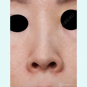 聖心美容クリニック 横浜院 佐々木 直美医師の症例