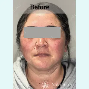 横浜山手クリニック 平山 桂子医師の症例