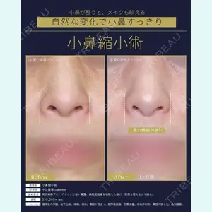 聖心美容クリニック 広島院 中辻 隆徳医師の症例