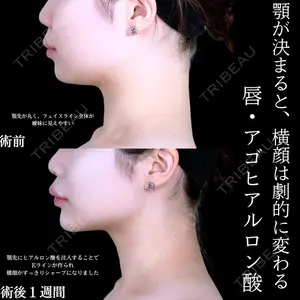 アリエル美容クリニック 水戸院 天白 典秀医師の症例