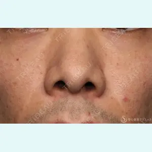 聖心美容クリニック 大宮院 伊藤 哲郎医師の症例