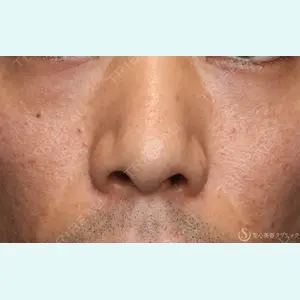 聖心美容クリニック 大宮院 伊藤 哲郎医師の症例