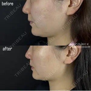 Clinic K Blossomの症例