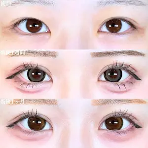 アリエル美容クリニック 大宮院 鈴木　桂介医師の症例