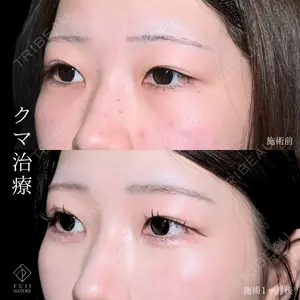 藤・ナチュレ美容クリニック 銀座院 小川 杏平医師の症例
