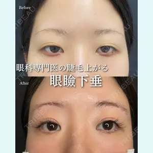 ルラ美容クリニック 渋谷本院 住友 沙織医師の症例