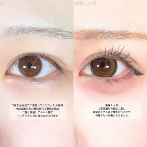 アリエル美容クリニック 大宮院 鈴木　桂介医師の症例