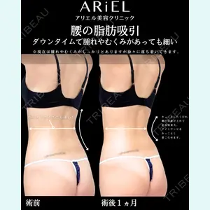 アリエル美容クリニック 横浜院 加藤 敏次医師の症例