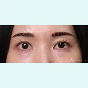 聖心美容クリニック 横浜院 佐々木 直美医師の症例