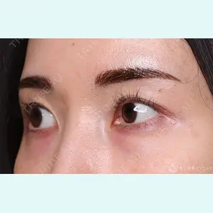 聖心美容クリニック 横浜院 佐々木 直美医師の症例