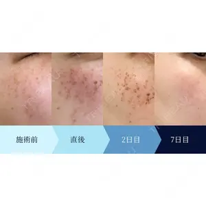 LA MER CLINIC 辻 航平医師の症例