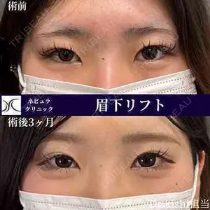 ネビュラクリニック 京都院 岸 大輔医師の症例