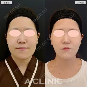 A CLINIC（エークリニック） 名古屋院 住田 篤紀医師の症例