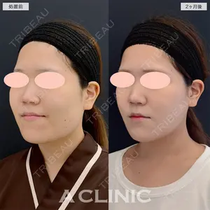 A CLINIC（エークリニック） 名古屋院 住田 篤紀医師の症例