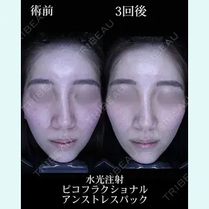 HAAB BEAUTY CLINIC 名古屋院の症例