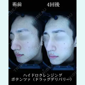 HAAB BEAUTY CLINIC 名古屋院の症例