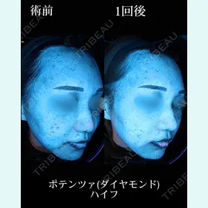 HAAB BEAUTY CLINIC 名古屋院の症例