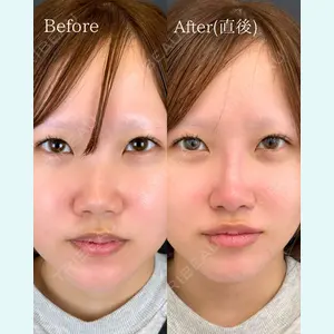 ルラ美容クリニック 広島院 角南 亮輔医師の症例