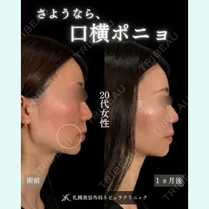 札幌美容外科ネビュラクリニック 横田 開医師の症例