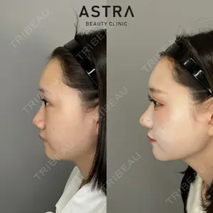 ASTRA BEAUTY CLINIC 塩満 惠子医師の症例