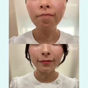 REVO CLINIC PLUS 結城 直哉医師の症例