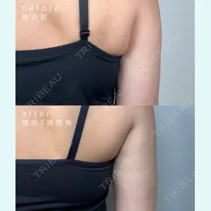 ミニマムスキンクリニック池袋の症例