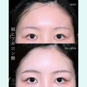 藤・ナチュレ美容クリニック 銀座院 小川 杏平医師の症例