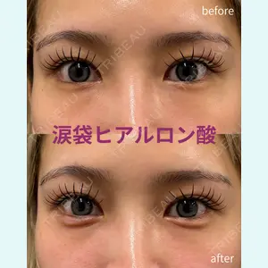 春山記念病院 山田 浩之医師の症例