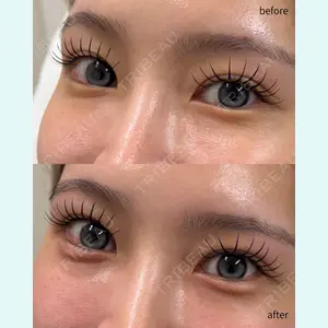 春山記念病院 山田 浩之医師の症例