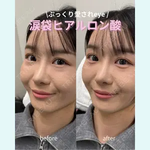 春山記念病院 山田 浩之医師の症例