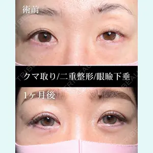 HAAB×DREAM BEAUTY CLINIC 大阪梅田院 鈴木 馨斗医師の症例