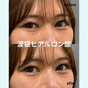 春山記念病院 山田 浩之医師の症例