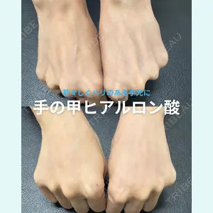 春山記念病院 山田 浩之医師の症例