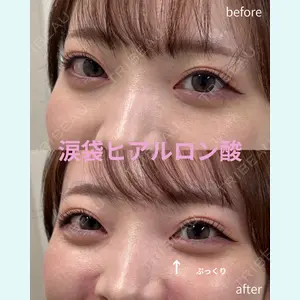 春山記念病院 山田 浩之医師の症例