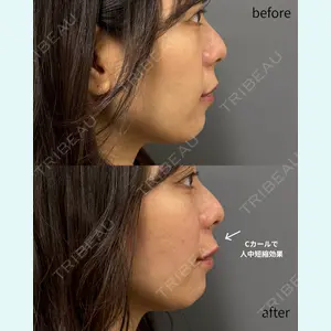 春山記念病院 山田 浩之医師の症例