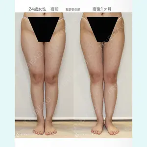 聖心美容クリニック 札幌院 前多 一彦医師の症例