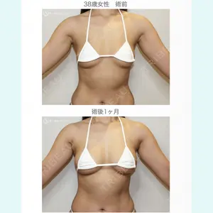 聖心美容クリニック 札幌院 前多 一彦医師の症例