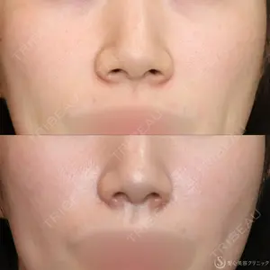 聖心美容クリニック 名古屋院 加藤 大典医師の症例