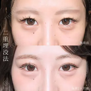 藤・ナチュレ美容クリニック 銀座院 小川 杏平医師の症例