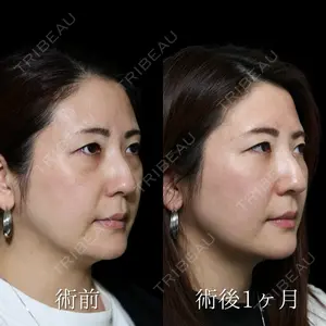 NARU Beauty Clinic 【ナルクリ】 倉津　諭医師の症例