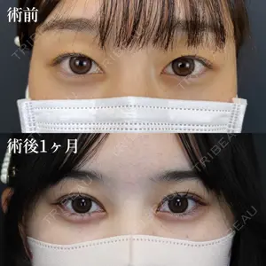 NARU Beauty Clinic 【ナルクリ】 石橋 成彦医師の症例