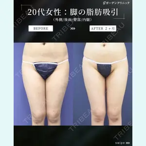 ガーデンクリニック 横浜院 藤原 康嗣医師の症例