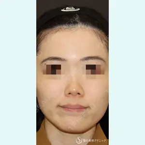 聖心美容クリニック 銀座院 牧野 陽二郎医師の症例