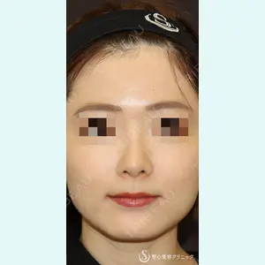 聖心美容クリニック 銀座院 牧野 陽二郎医師の症例