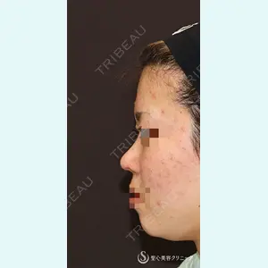 聖心美容クリニック 銀座院 牧野 陽二郎医師の症例