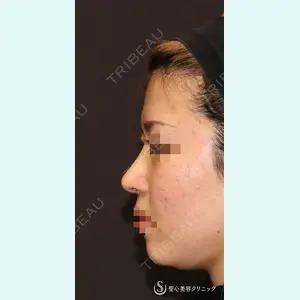 聖心美容クリニック 銀座院 牧野 陽二郎医師の症例