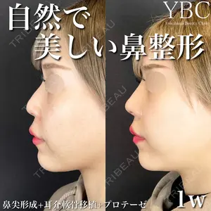 YBC横浜美容外科 大宮院 磯村 亮輔医師の症例