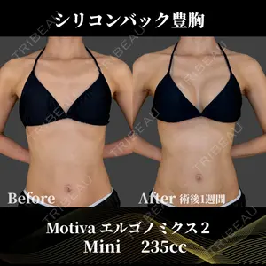 Belle Via Clinic 加藤 秀輝医師の症例